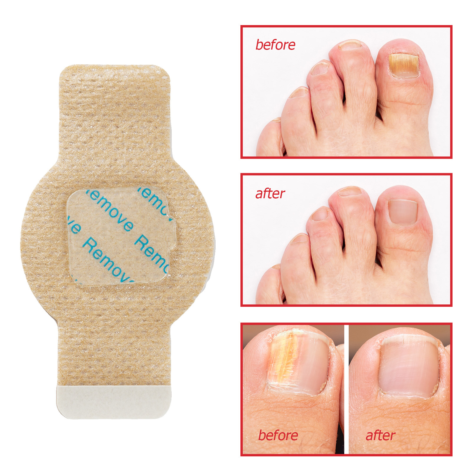 Nail repair patches comparison