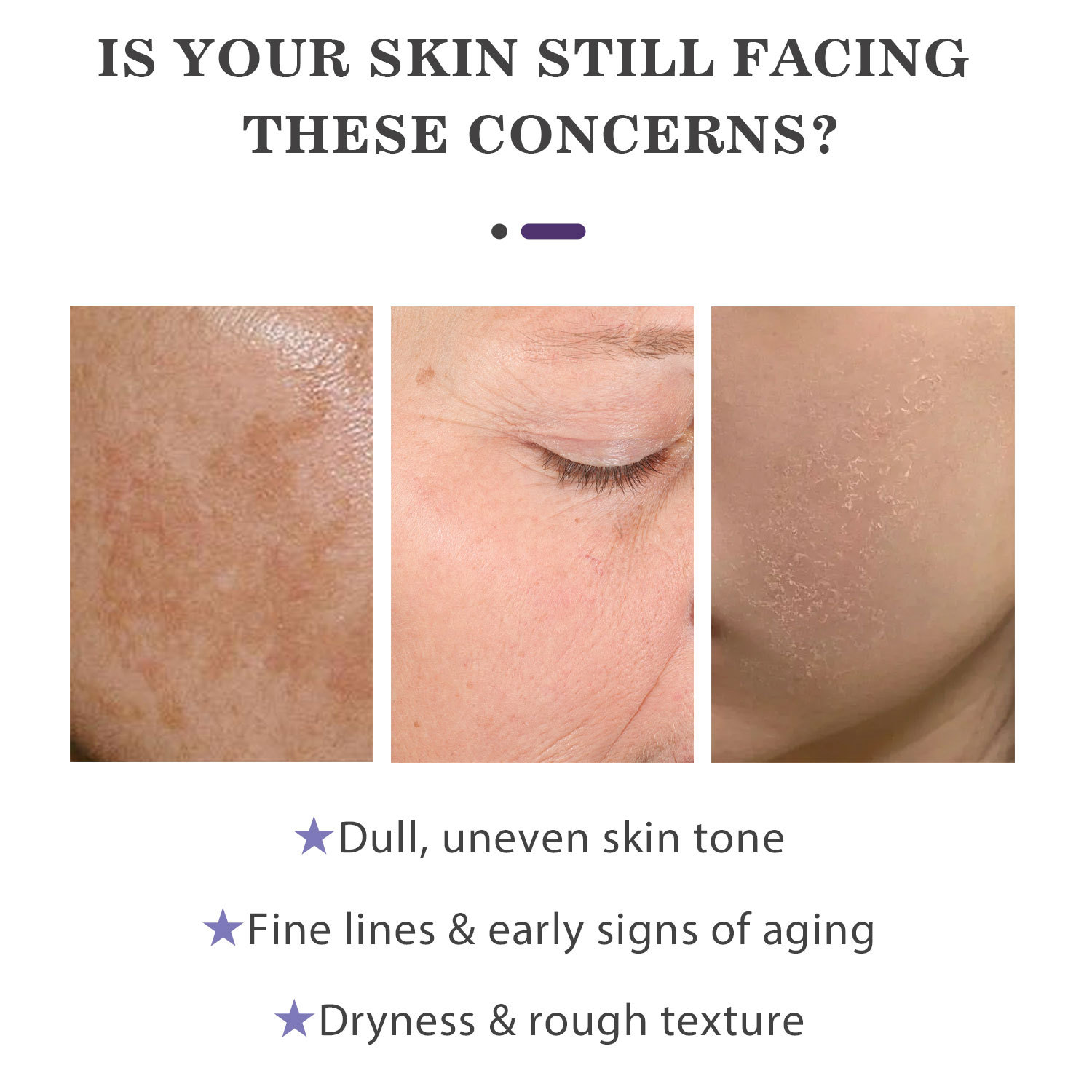 FP-F027NAD+PDRN??????_02