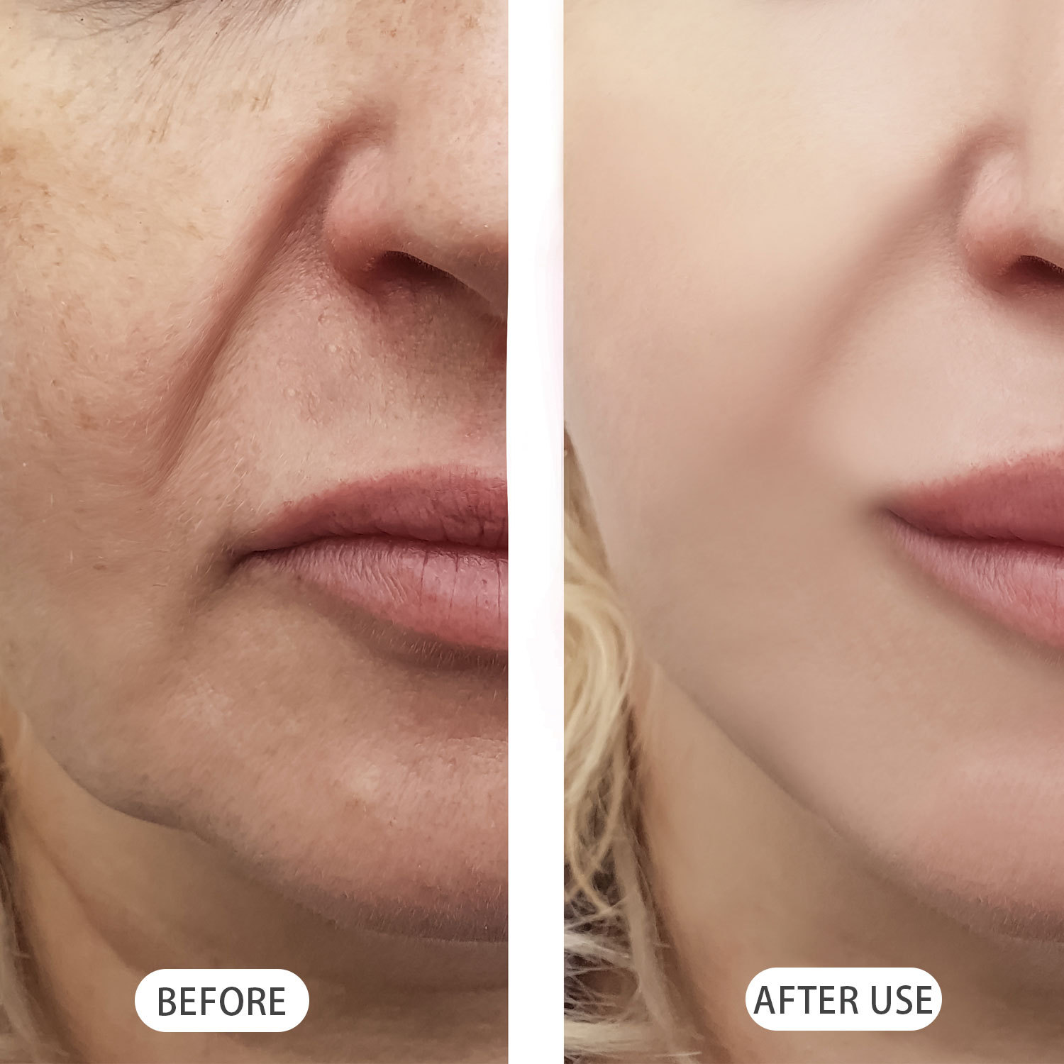 FP-F027NAD+PDRN??????_05