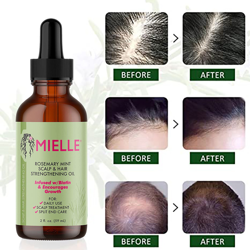 Biotin Hair Strengthening Oil