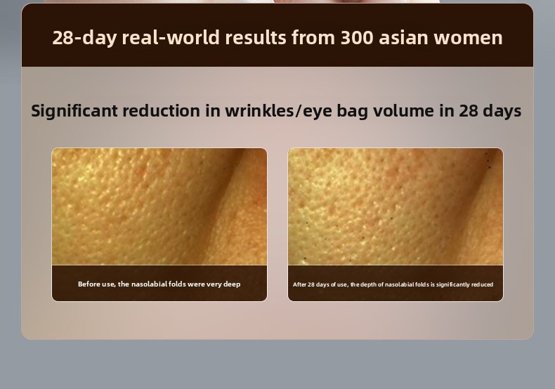 Anti-Wrinkle Face Lifting Tool