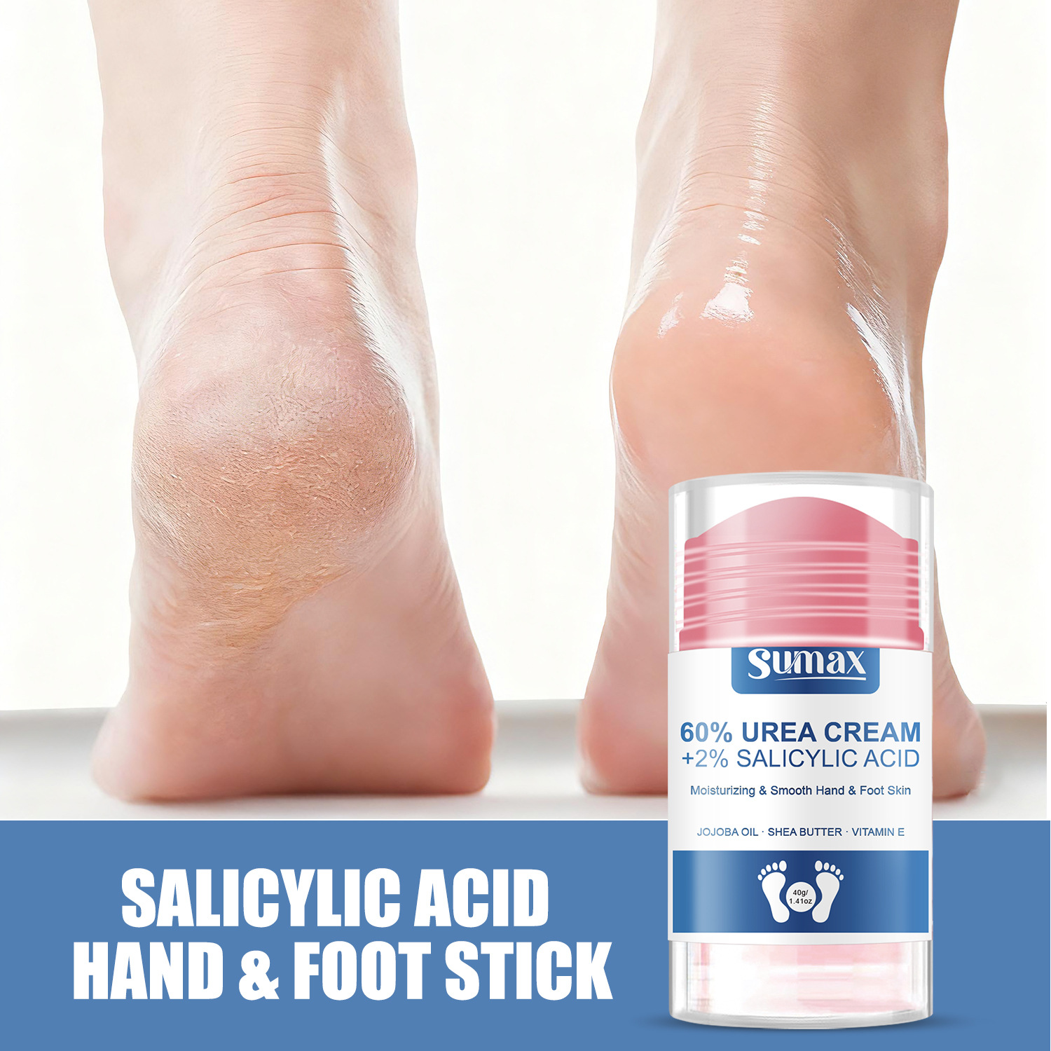 Voyage Queens Salicylic Acid Foot and Hand Cream