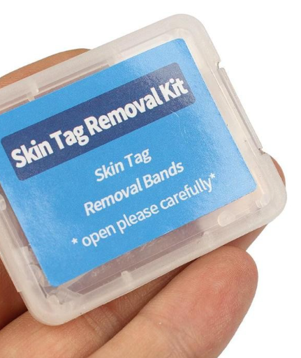 Rubber Band Wart Remover