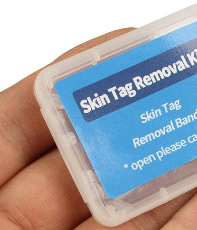 Rubber Band Wart Remover