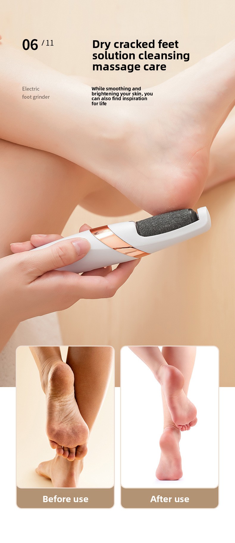 Rechargeable Electric Foot File for Dead Skin Removal