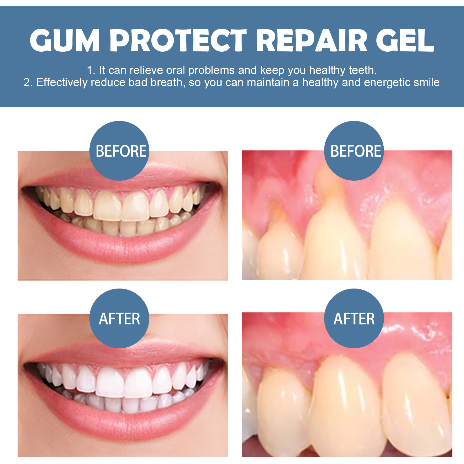 Gum Repair Gel