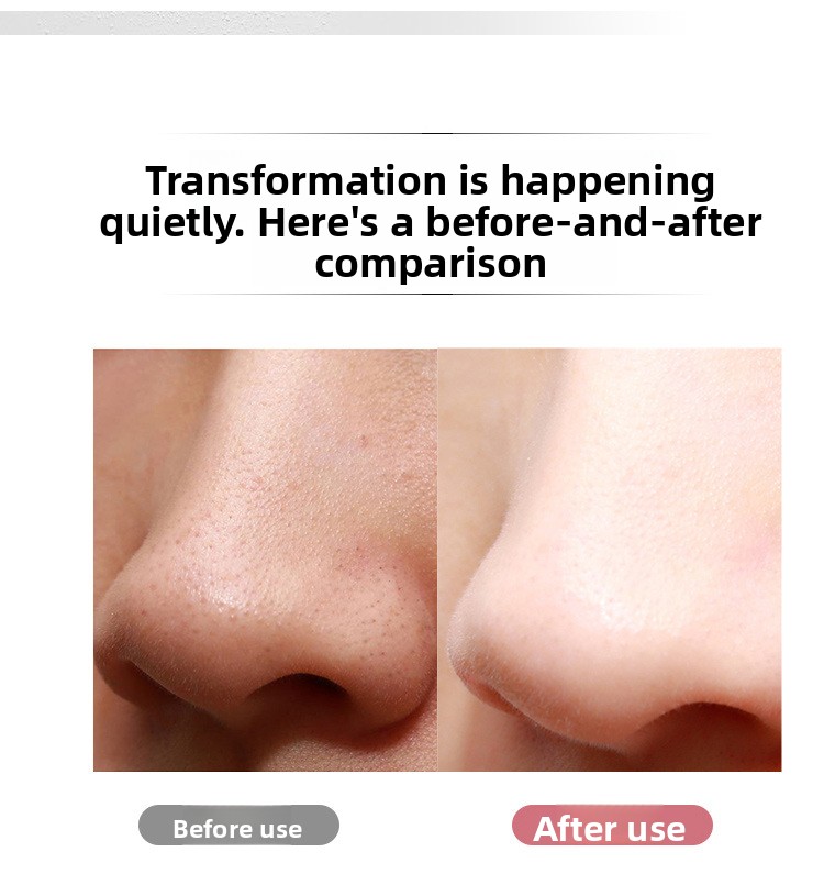 Portable Ultrasonic Facial Cleanser