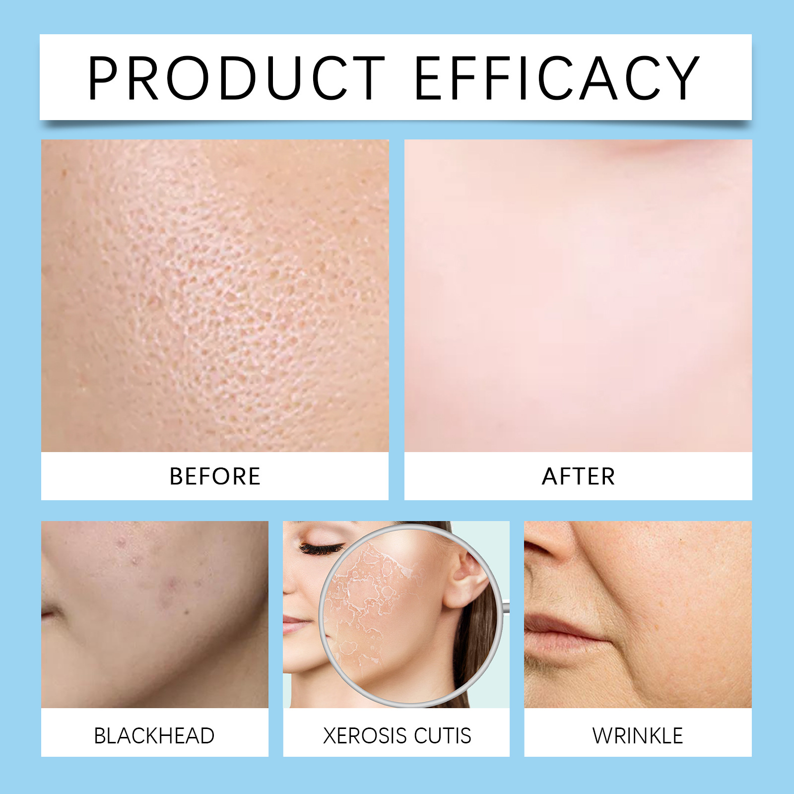Hyaluronic acid roller essence to improve skin pores